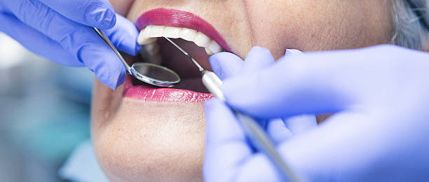Best Emergency Dental Care for Abscessed Tooth in El Dorado Hills, CA